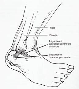 distorsione alla caviglia